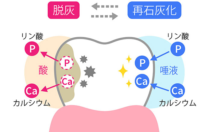 虫歯・歯周病を予防する重要性