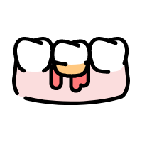  歯周病治療 